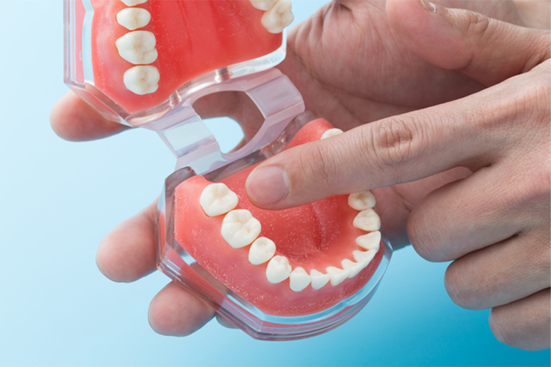 口腔外科小手術とは